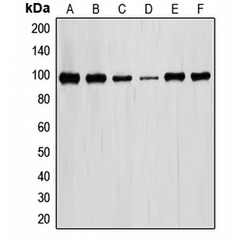 STAT6 Rabbit Polyclonal Antibody