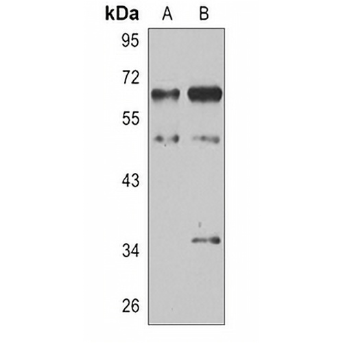 MST2 Rabbit Polyclonal Antibody