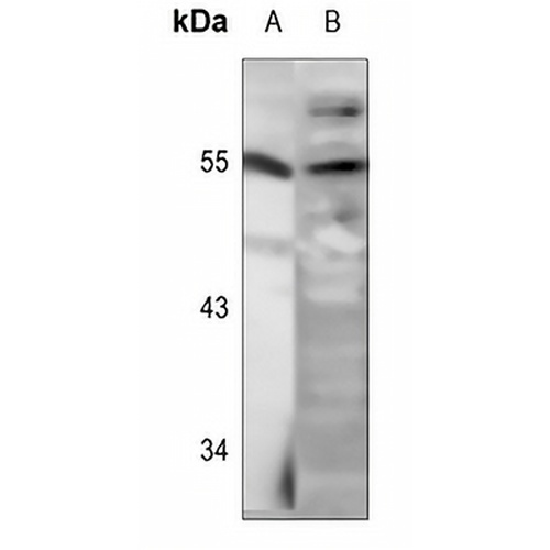 LKB1 (Phospho-S428) Rabbit Polyclonal Antibody