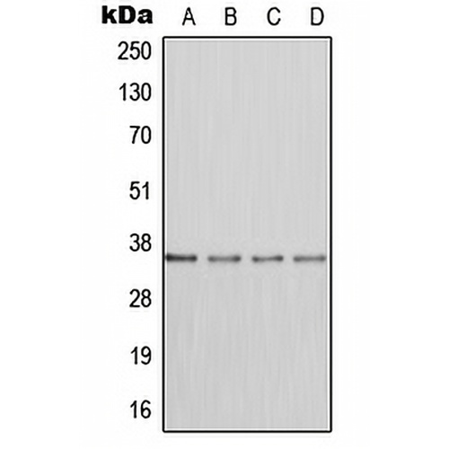 DHEA-ST Rabbit Polyclonal Antibody