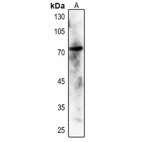 SYK (Phospho-Y348) Rabbit Polyclonal Antibody