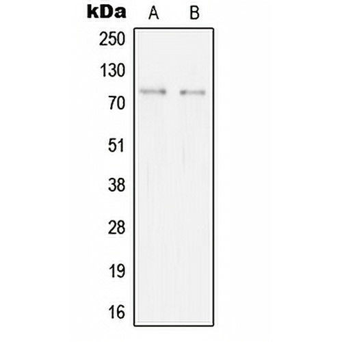 SYK Rabbit Polyclonal Antibody