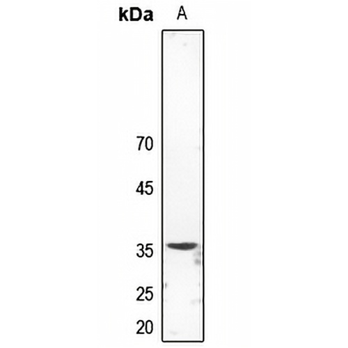 Synaptophysin Rabbit Polyclonal Antibody