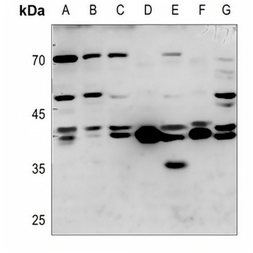 TCF7 Rabbit Polyclonal Antibody