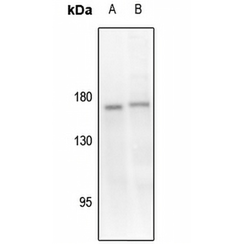 TIE2 (Phospho-Y1108) Rabbit Polyclonal Antibody