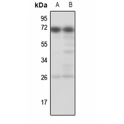 TESK1 Rabbit Polyclonal Antibody