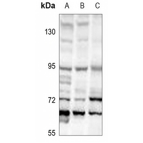 TFE3 Rabbit Polyclonal Antibody