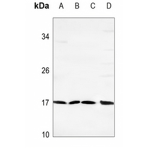 Spasmolysin Rabbit Polyclonal Antibody
