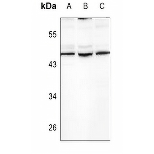TGF beta 2 Rabbit Polyclonal Antibody