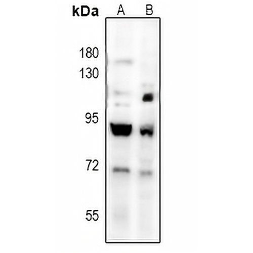 TGFBR2 Rabbit Polyclonal Antibody
