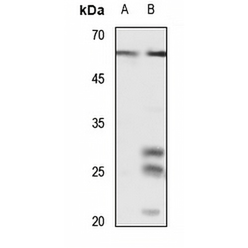 CD141 Rabbit Polyclonal Antibody