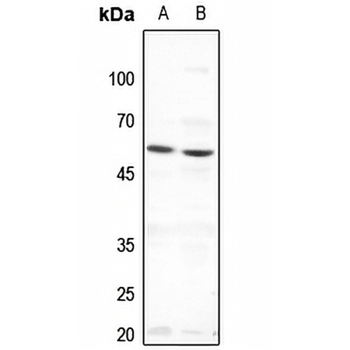 THRA Rabbit Polyclonal Antibody