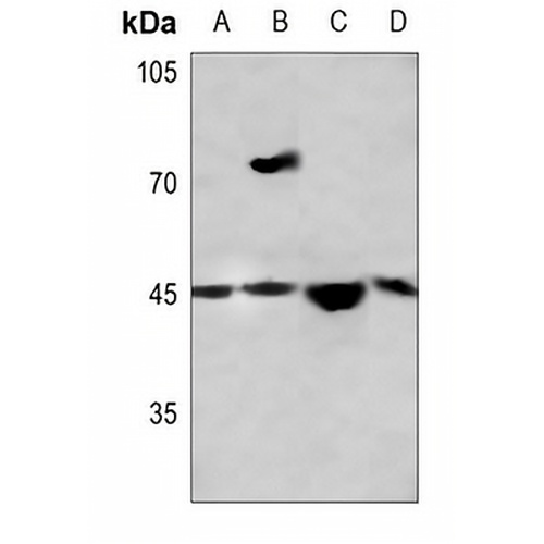 THRB Rabbit Polyclonal Antibody