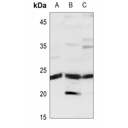 TIMP2 Rabbit Polyclonal Antibody