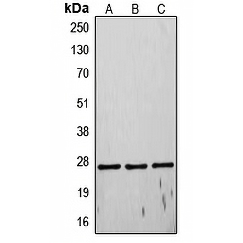 TIMP4 Rabbit Polyclonal Antibody
