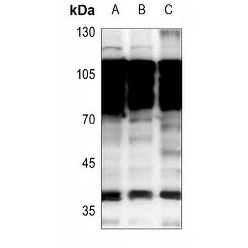 NKX2-1 Rabbit Polyclonal Antibody