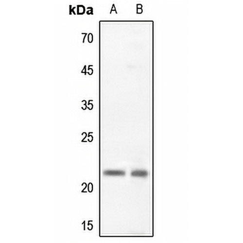 Claudin 5 Rabbit Polyclonal Antibody