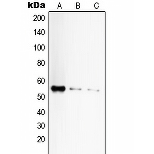 CD120a Rabbit Polyclonal Antibody