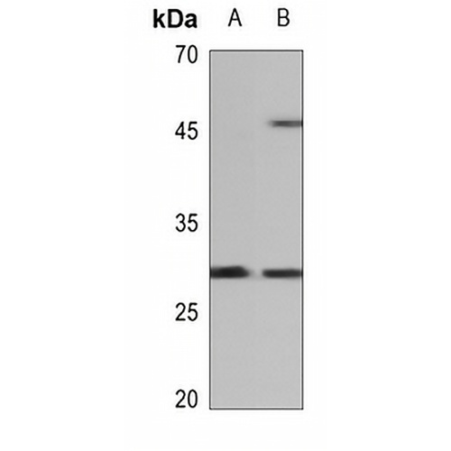 cTnI Rabbit Polyclonal Antibody