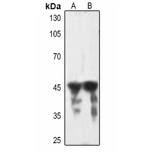 cTnT Rabbit Polyclonal Antibody