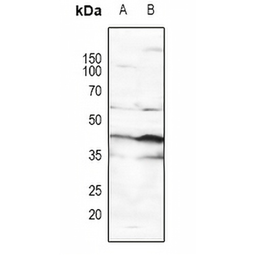 p53 (Phospho-S15) Rabbit Polyclonal Antibody