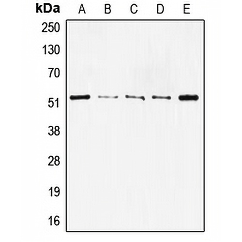 p53 Rabbit Polyclonal Antibody