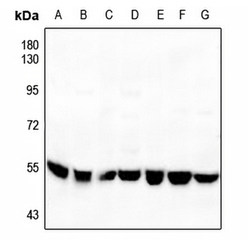 p53 Rabbit Polyclonal Antibody