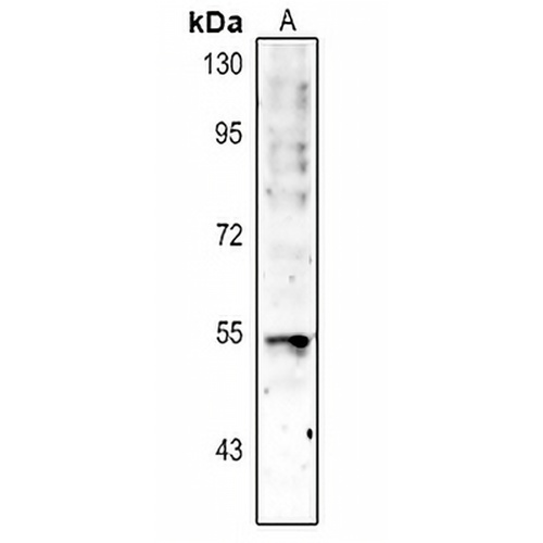 p53 Rabbit Polyclonal Antibody
