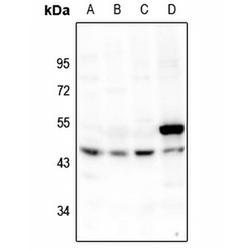 p53 Rabbit Polyclonal Antibody