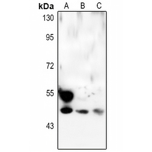 p53 Rabbit Polyclonal Antibody