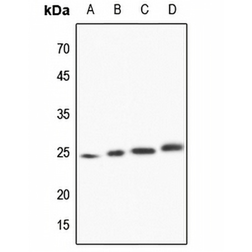TCTP Rabbit Polyclonal Antibody