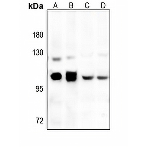 GRP94 Rabbit Polyclonal Antibody