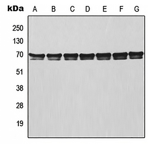 TRAF3 Rabbit Polyclonal Antibody
