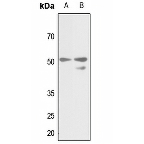Gamma-tubulin Rabbit Polyclonal Antibody