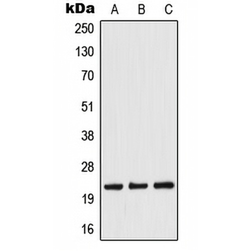 TWIST Rabbit Polyclonal Antibody