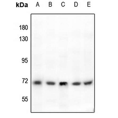 Tyrosinase Rabbit Polyclonal Antibody