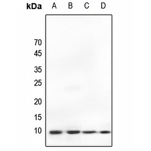 Ub Rabbit Polyclonal Antibody