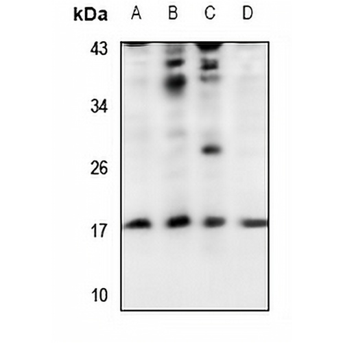 UBE2A/B Rabbit Polyclonal Antibody