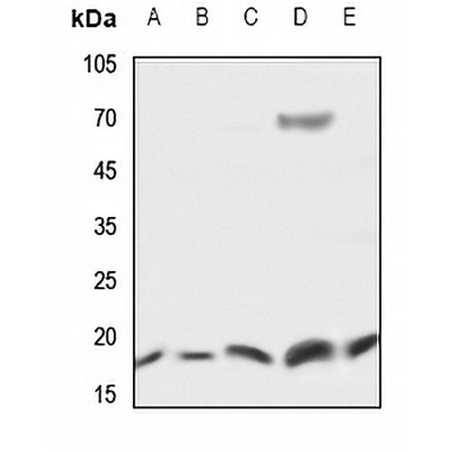 UBE2D2 Rabbit Polyclonal Antibody