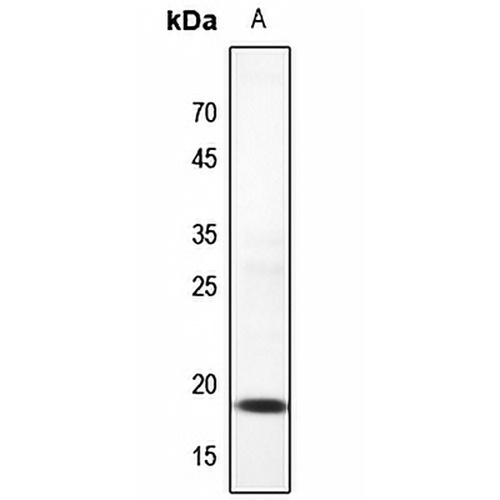 UBC9 Rabbit Polyclonal Antibody