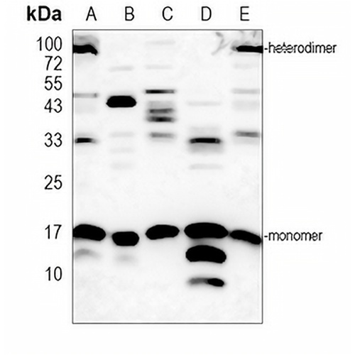 SUMO1 Rabbit Polyclonal Antibody