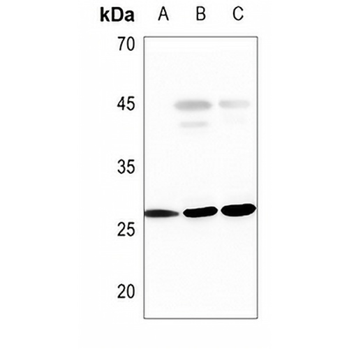 PGP9.5 Rabbit Polyclonal Antibody