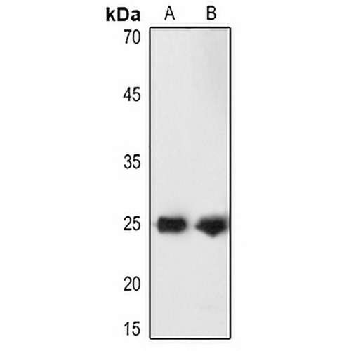 PGP9.5 Rabbit Polyclonal Antibody