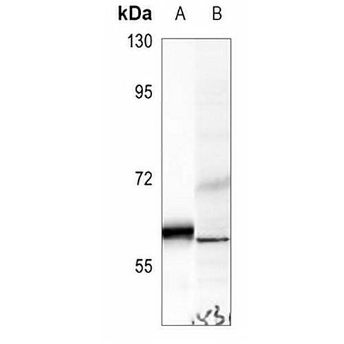 UGCG Rabbit Polyclonal Antibody