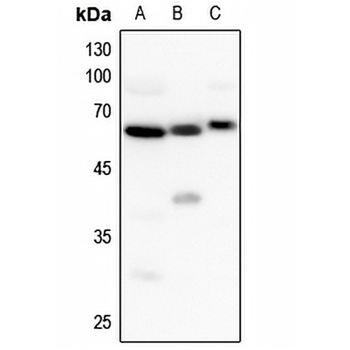 UGT8 Rabbit Polyclonal Antibody