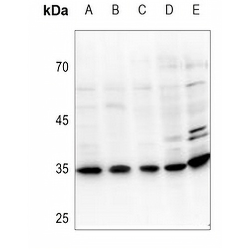 UDG Rabbit Polyclonal Antibody