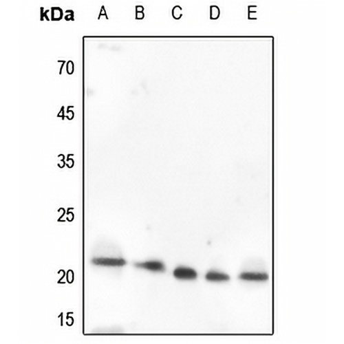 VEGFB Rabbit Polyclonal Antibody