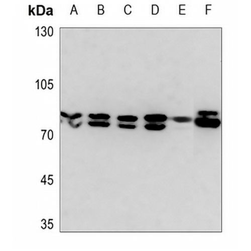 Ezrin Rabbit Polyclonal Antibody