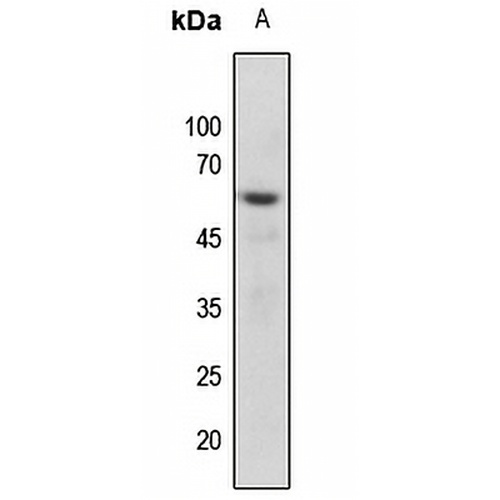 Vimentin (Phospho-S56) Rabbit Polyclonal Antibody