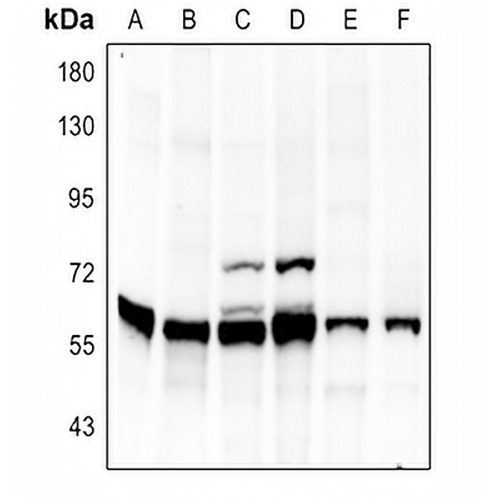 Vimentin Rabbit Polyclonal Antibody